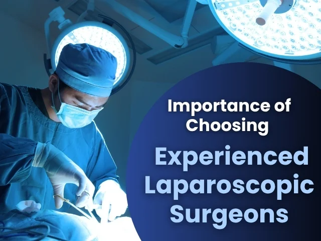 Importance of Choosing Experienced Laparoscopic Surgeons