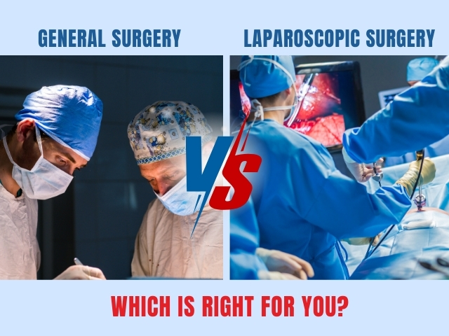 How Laparoscopic Surgery is Revolutionizing Modern Medical Procedures